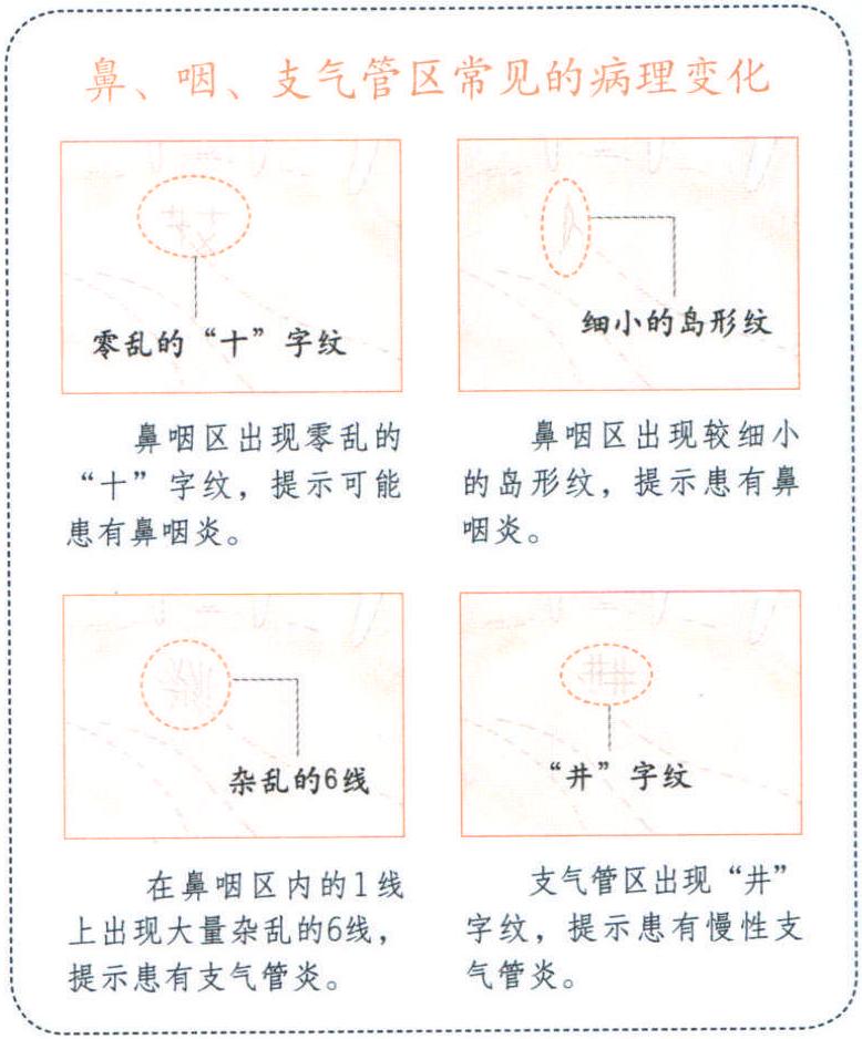 手掌上的鼻、咽、支氣管區(qū)